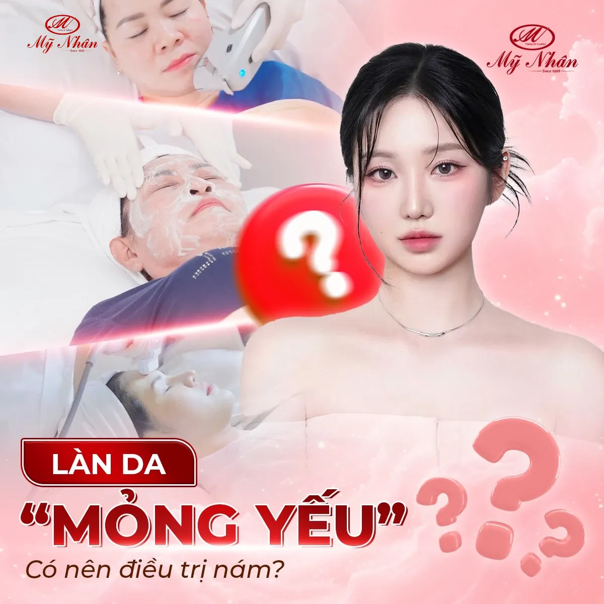 Da mỏng có nên trị nám không?