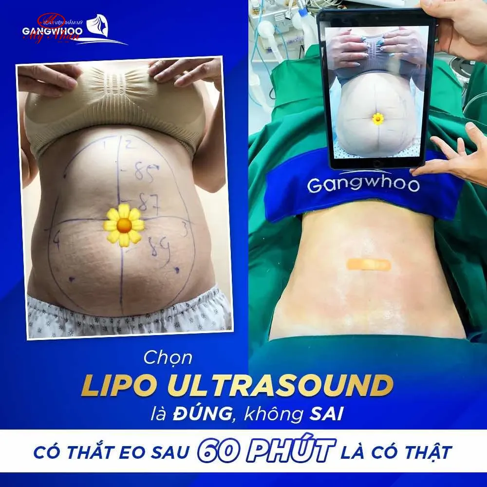 Tổng hợp thông tin về 'phốt' Bệnh viện Gangwhoo
