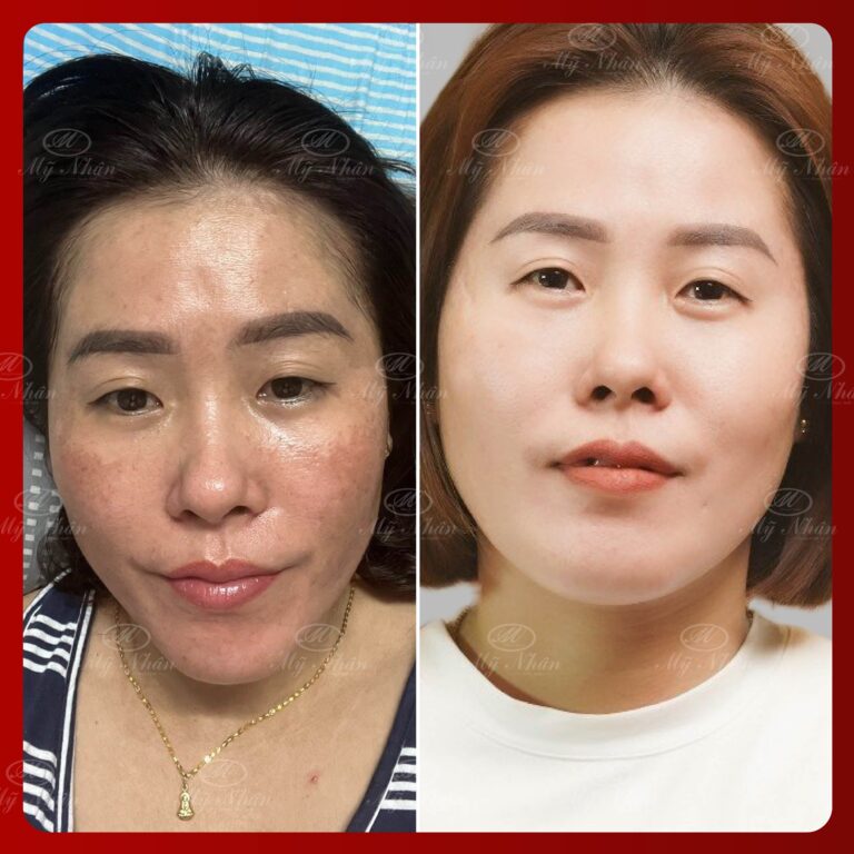 Kết quả khách hàng 1