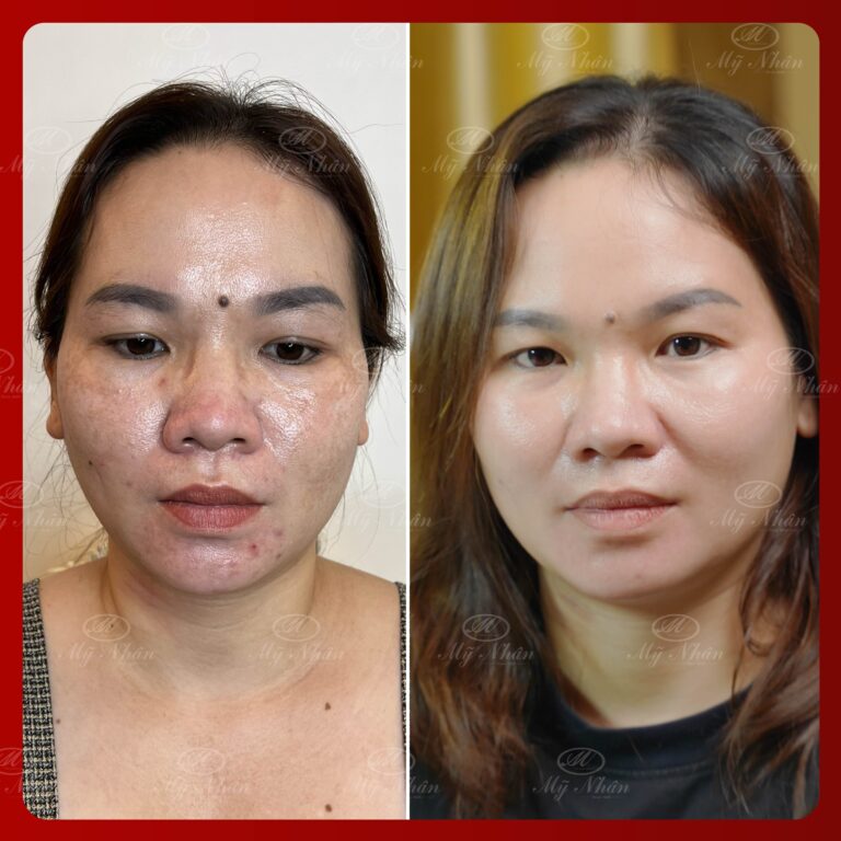 Kết quả khách hàng 2
