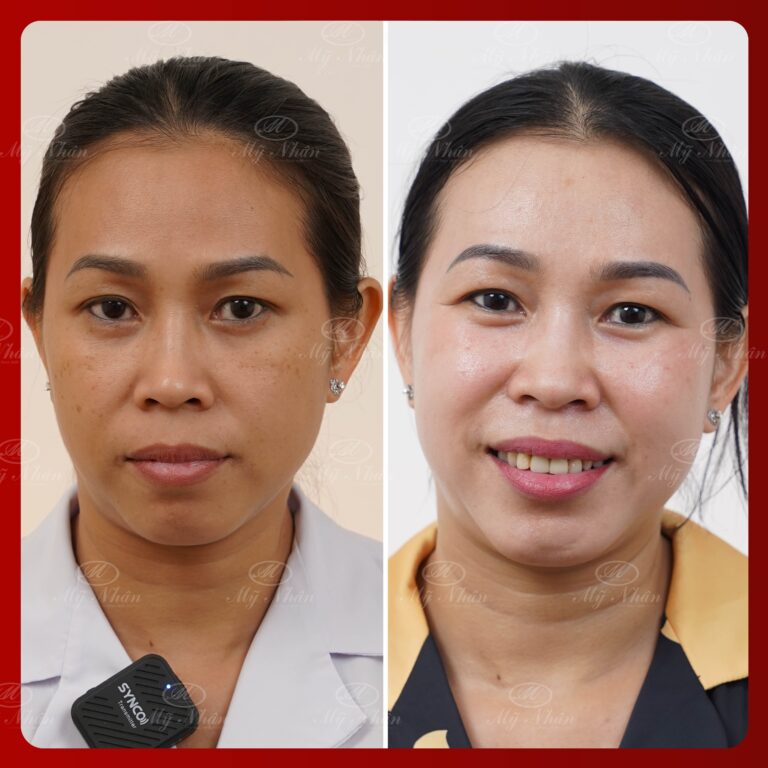 Kết quả khách hàng 3