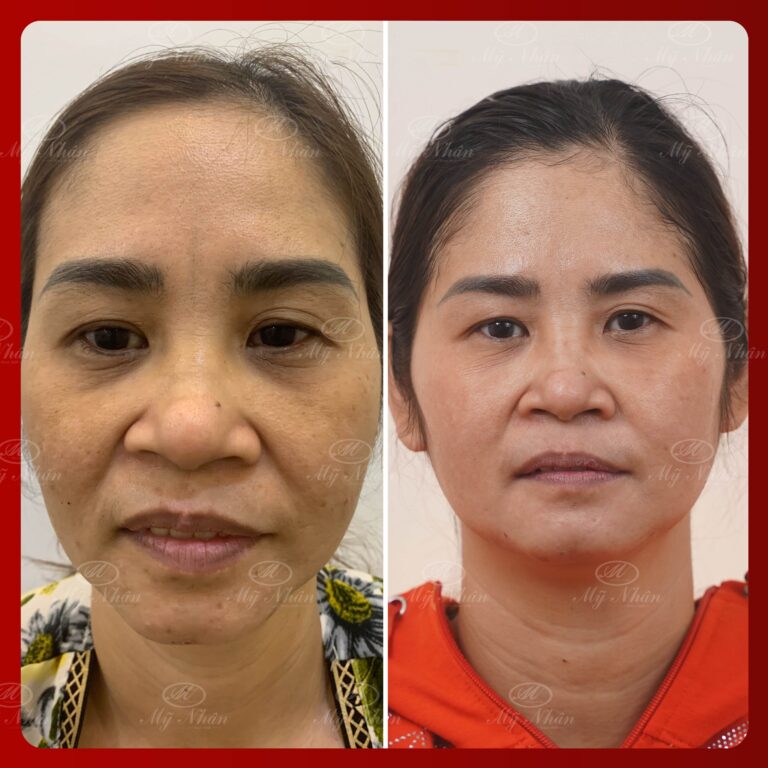 Kết quả khách hàng 4