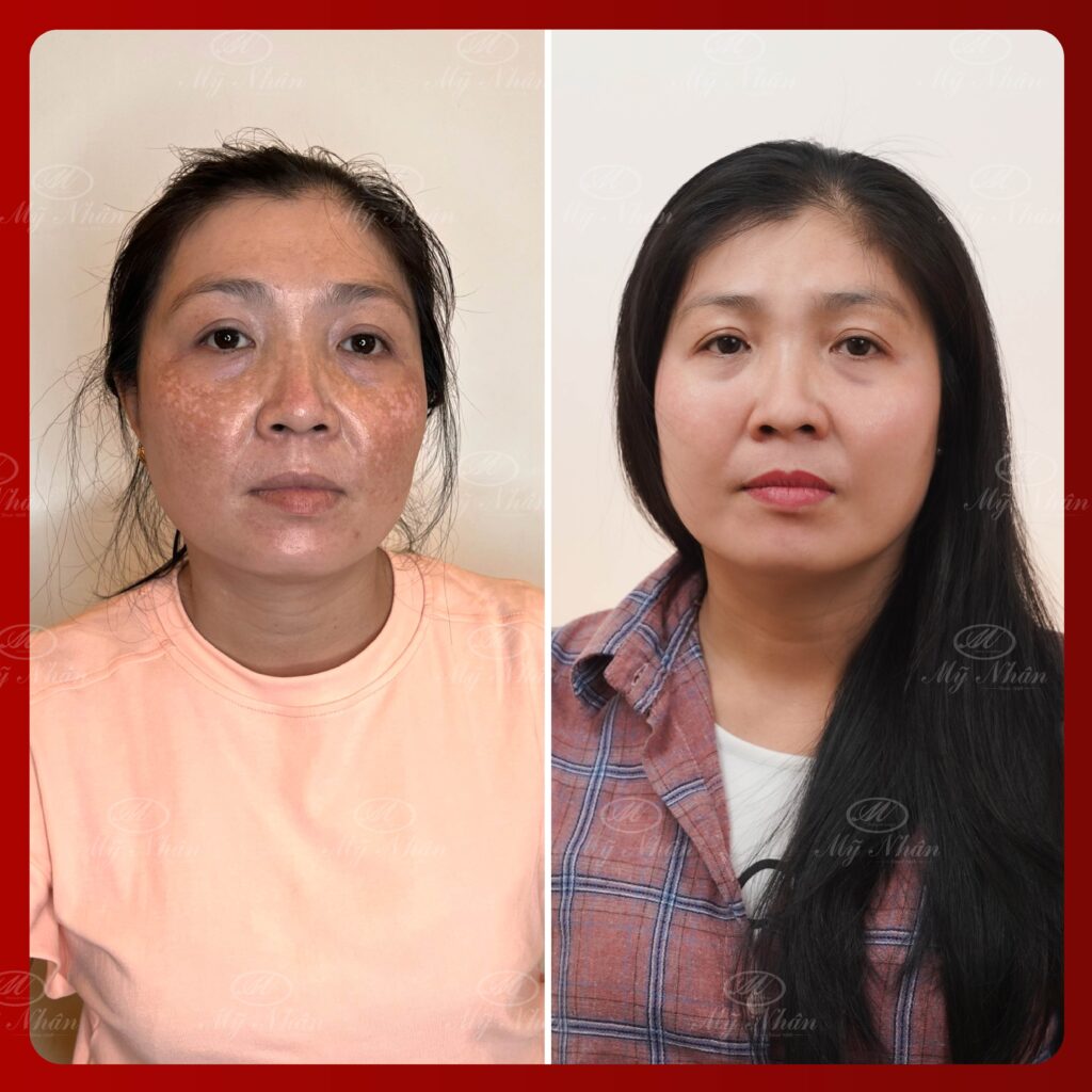 Kết quả khách hàng 5