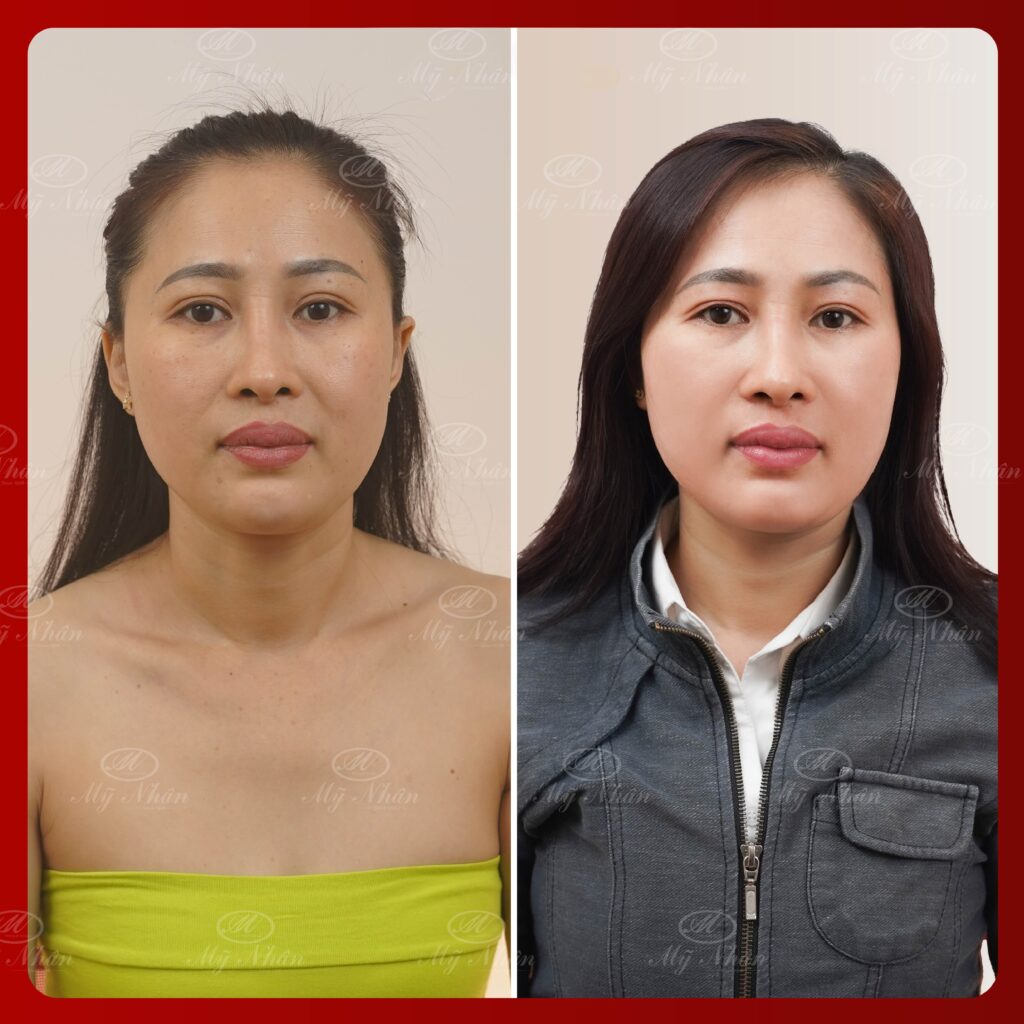 Kết quả khách hàng 6