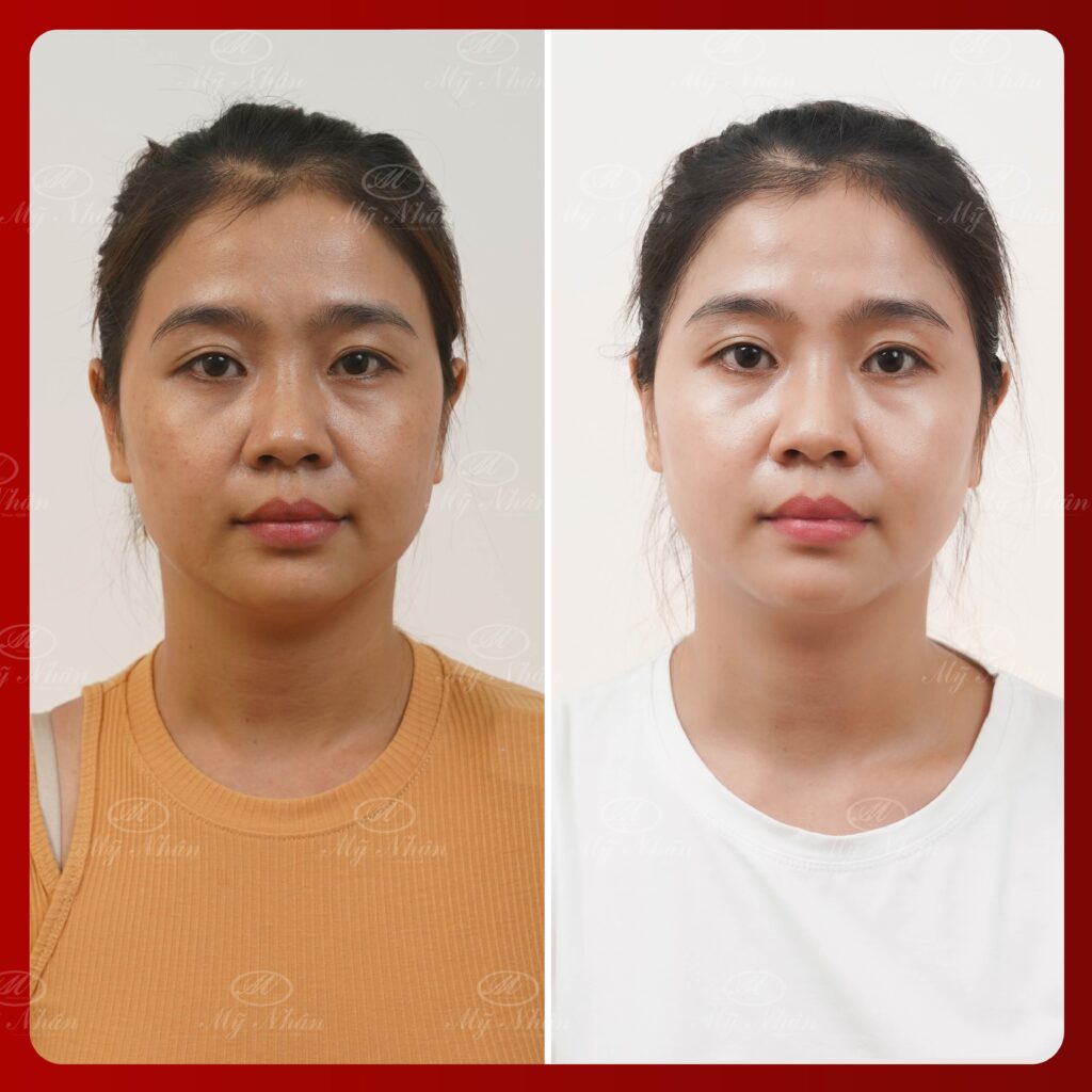 Kết quả khách hàng 7