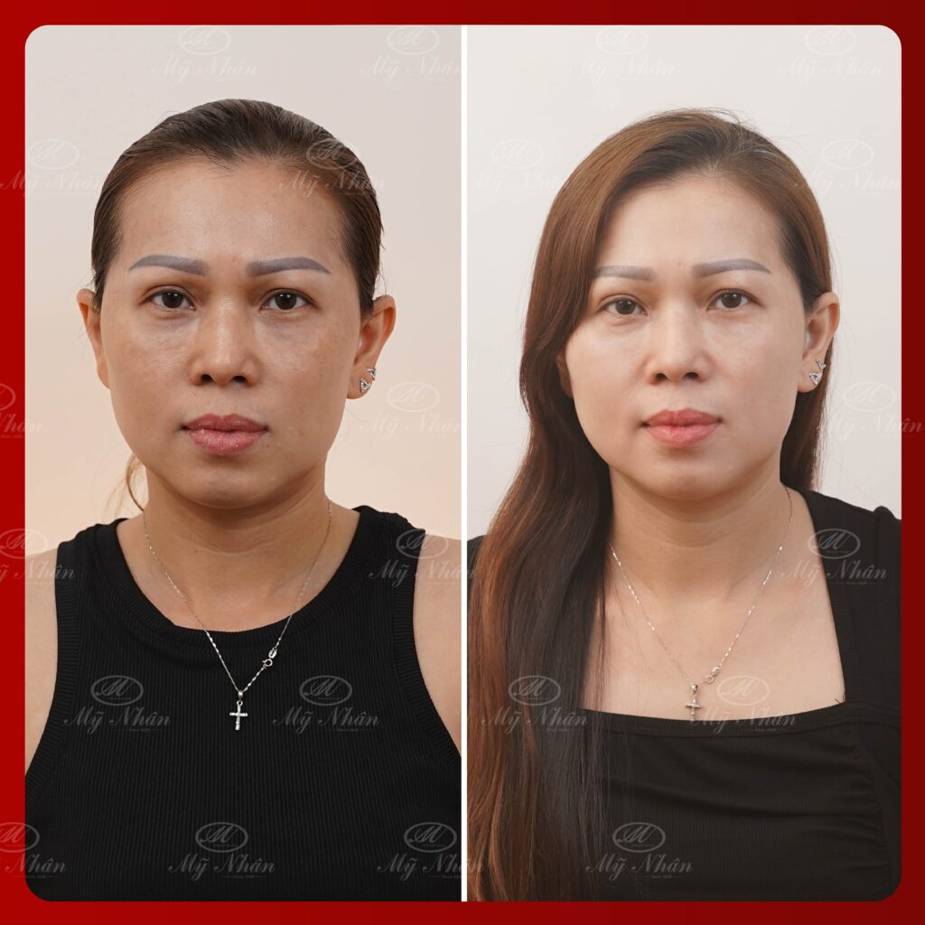 Kết quả khách hàng 8
