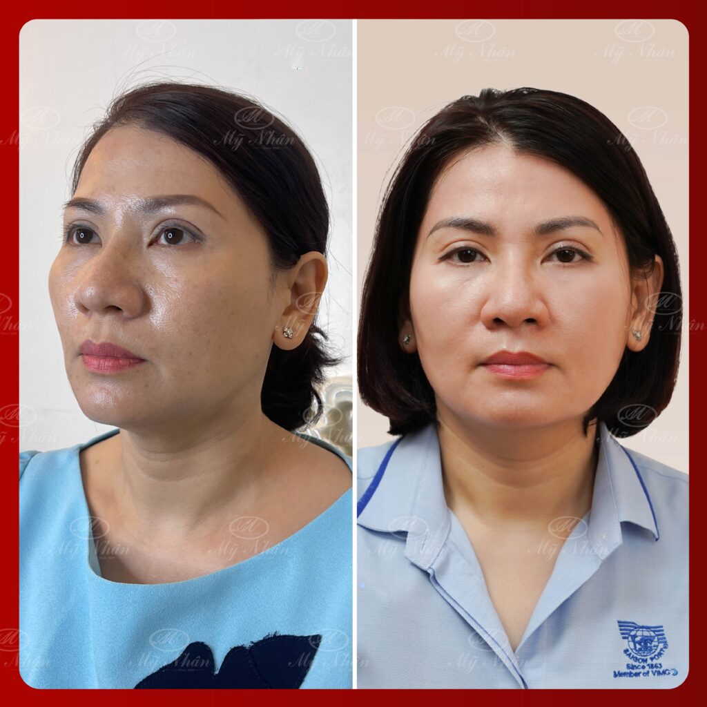 Kết quả khách hàng 9